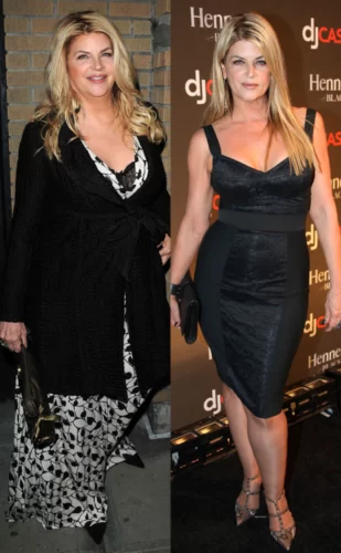 Kirstie alley before and after